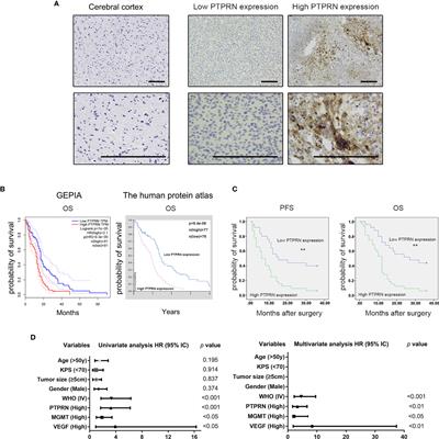 Expression and Tumor-Promoting Effect of Tyrosine Phosphatase Receptor Type N (PTPRN) in Human Glioma